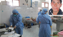 Manifestante de Calca falleció por edema pulmonar y cerebral