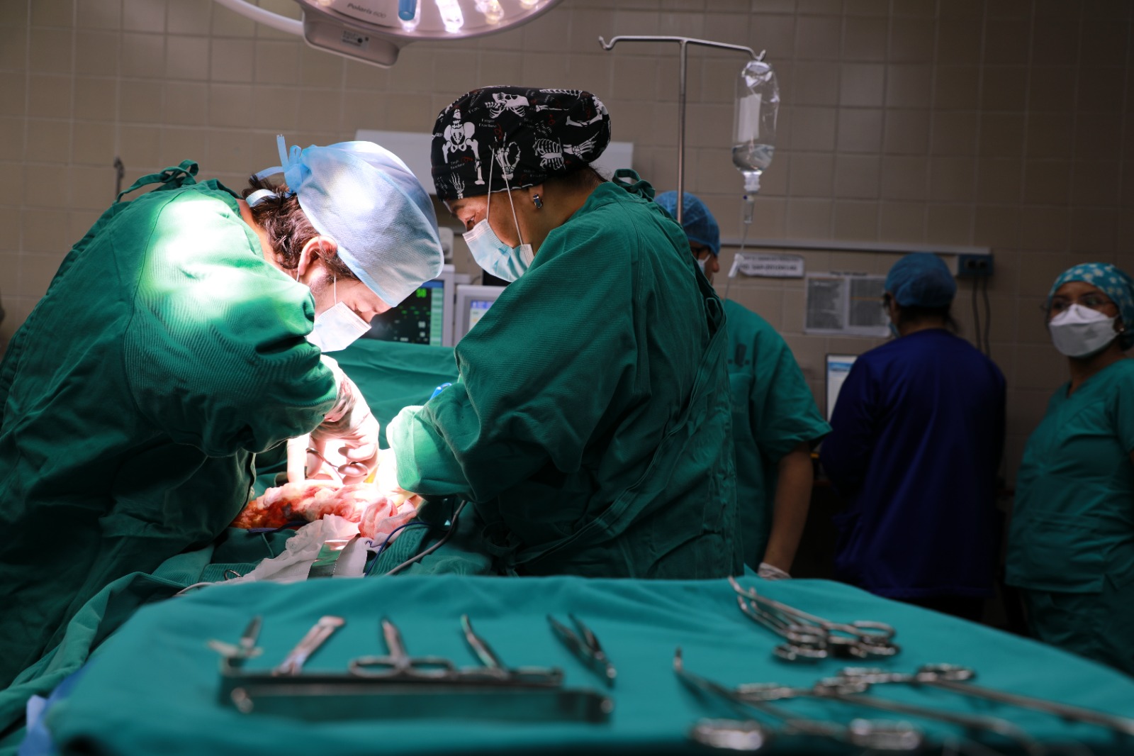 Médicos de EsSalud Cusco operan a niña deportista y le retiran tumor de 12 cm alojado en el páncreas